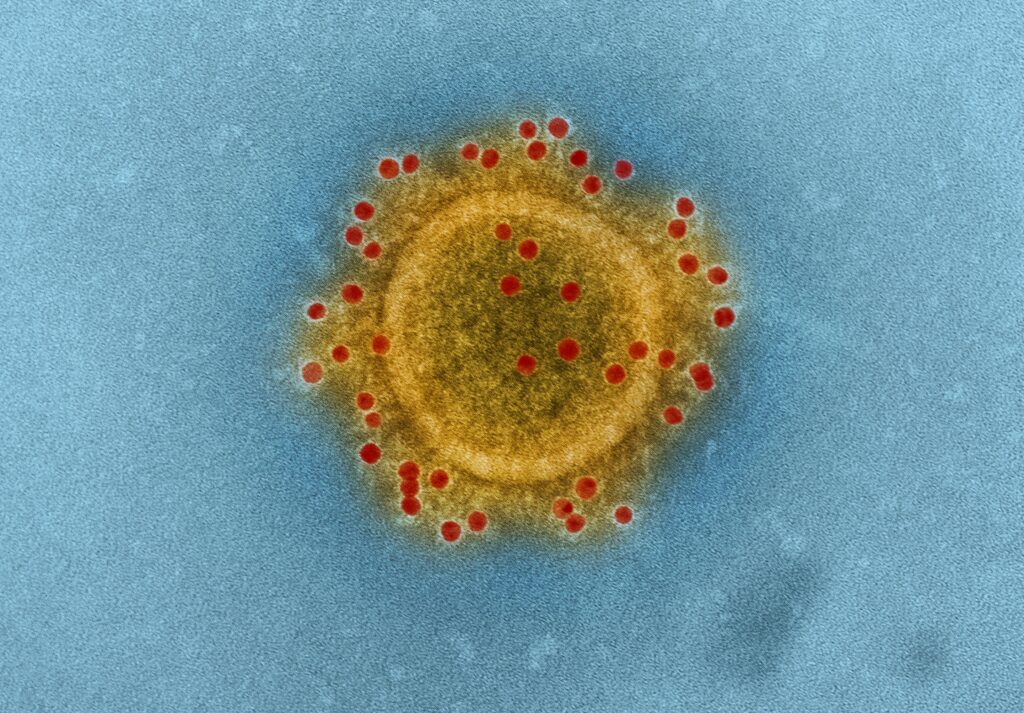 Coronavirus image